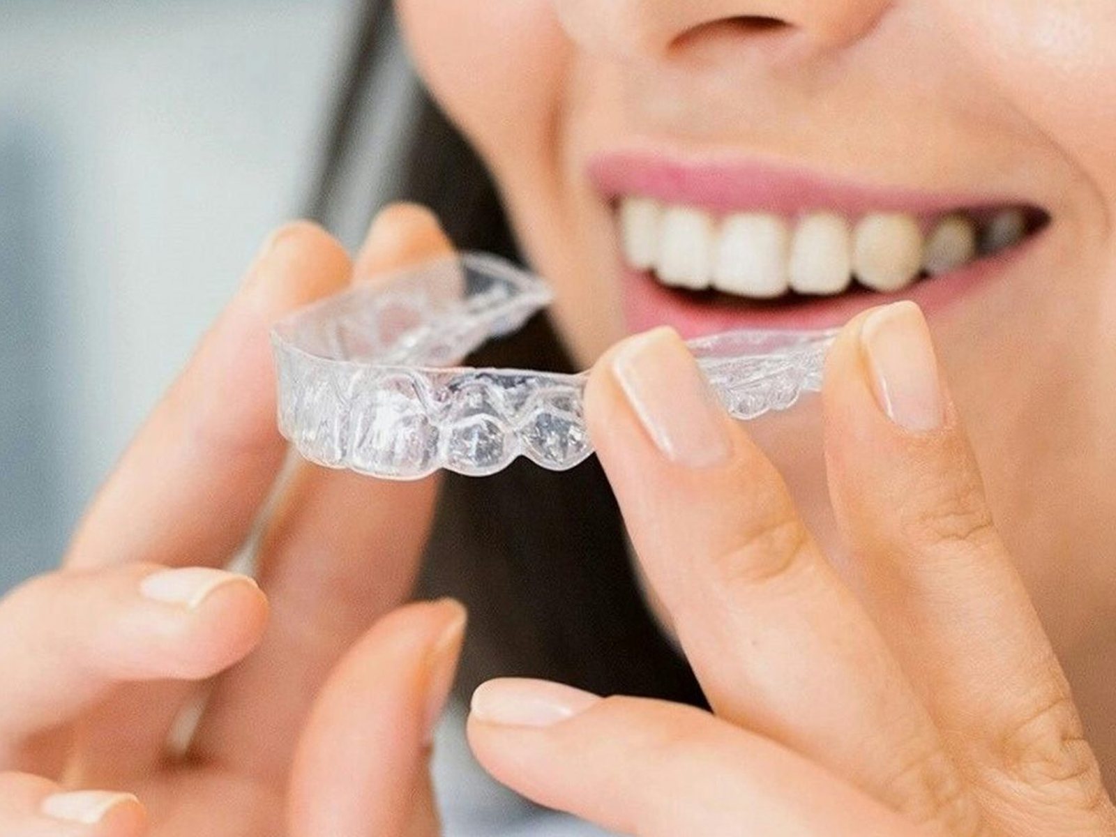 Kieferorthopädie für Erwachsene mit transparenten Alignern bei SmileHouse in Hitzkirch
