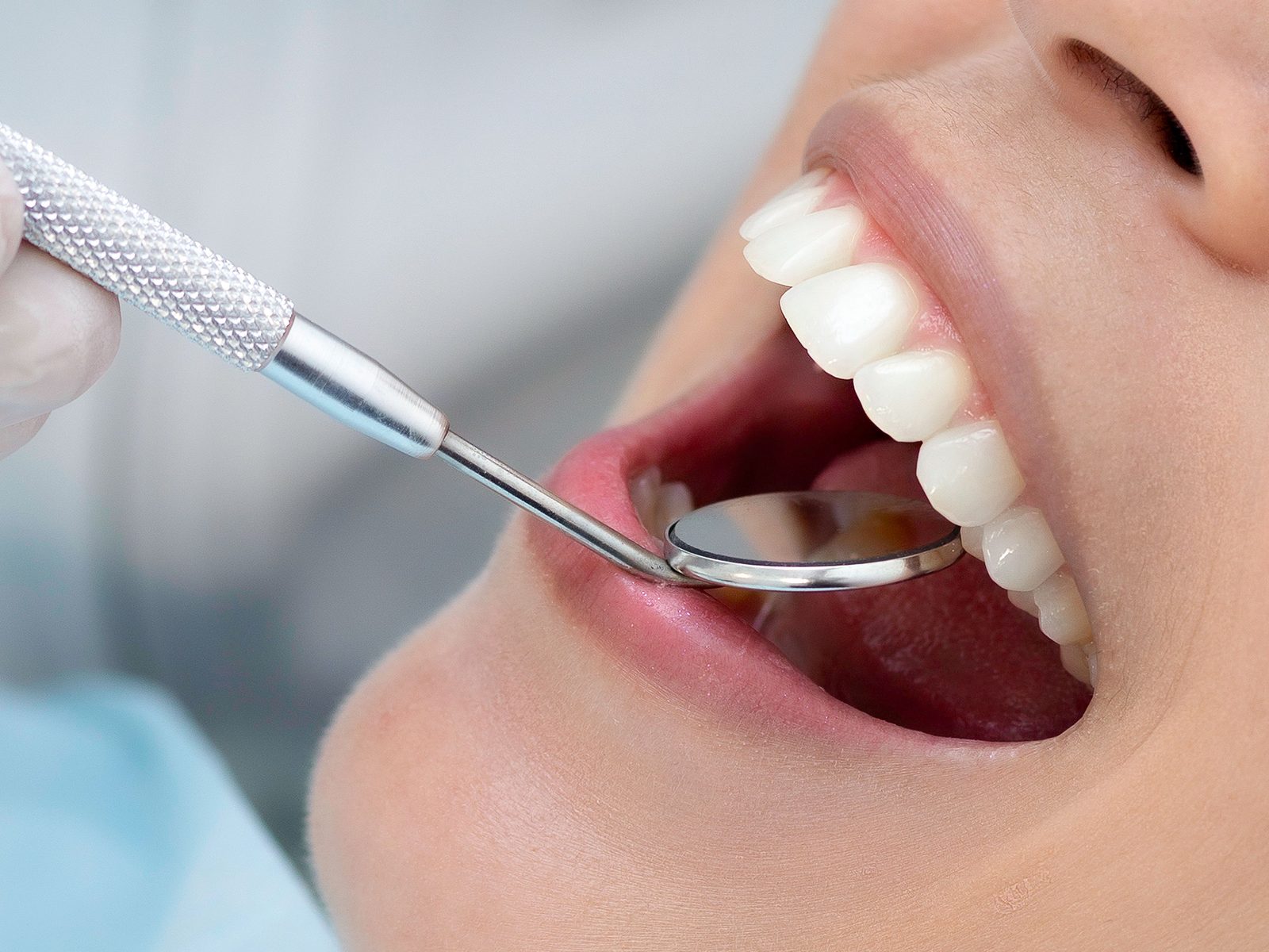 Professionelle Zahnreinigung und Prophylaxe bei SmileHouse, Kieferorthopädie in Hitzkirch